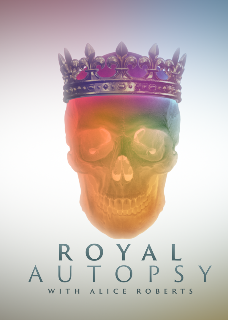 ROYAL AUTOPSY - thumbnail