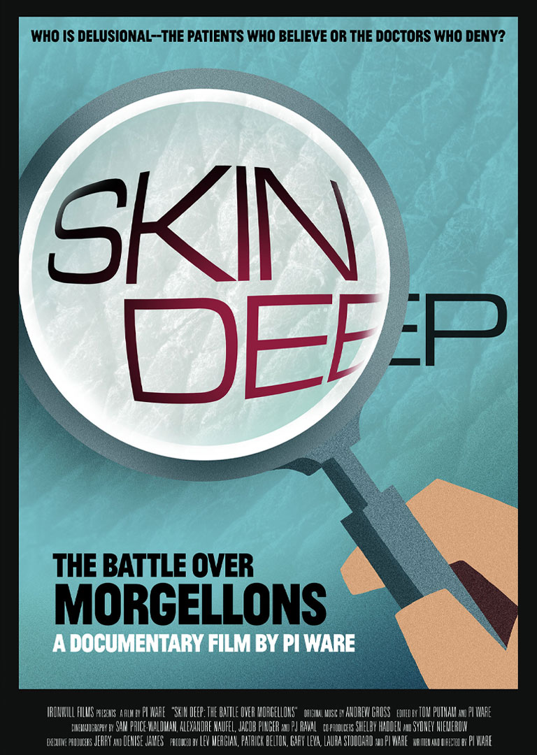 SKIN-DEEP---thumbnail